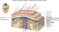 <p>Located above dura mater and below cranium (between skull and dura matter)</p>