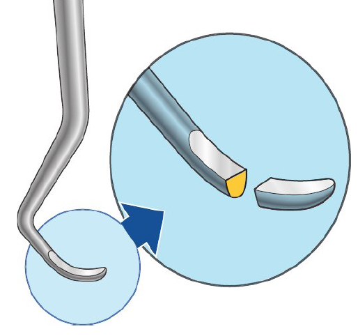 <ul><li><p>Semicircular</p></li><li><p>Round back</p></li><li><p>Round toe </p></li></ul><p></p><p>Use</p><ul><li><p>Remove calculus</p></li><li><p>Crowns</p></li><li><p>Roots</p></li><li><p>Subgingivally</p></li></ul><p></p>