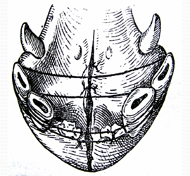 term image