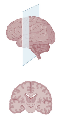 <p>Name this plane</p>