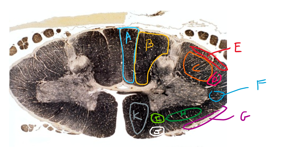 <p>List in order, the names of tracts A to K</p>