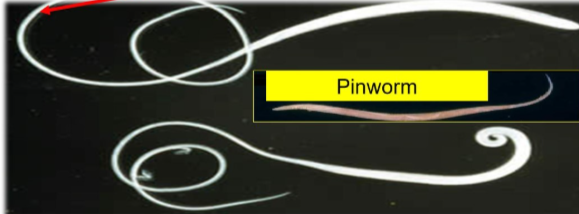 <p>Identify (not the pinworm)</p>