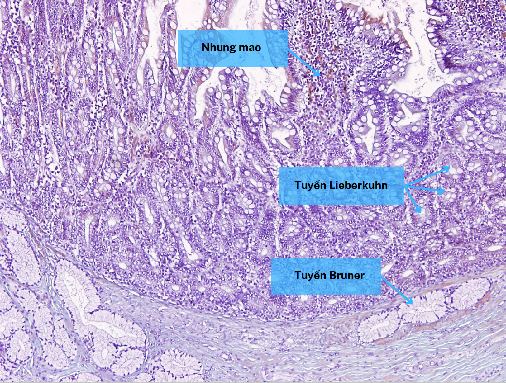 <ol><li><p>Nhung mao</p></li><li><p>Tuyến Lieberkühn</p></li><li><p>Tuyến Brunner</p></li></ol><p></p>