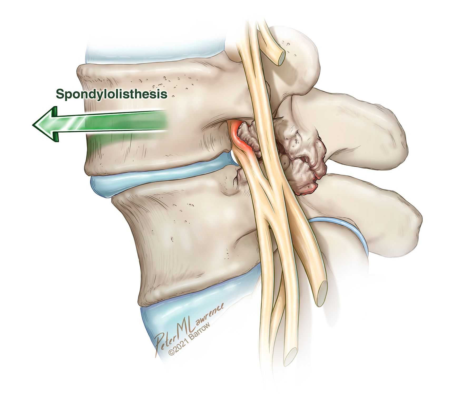 <p>What injury / condition? </p>