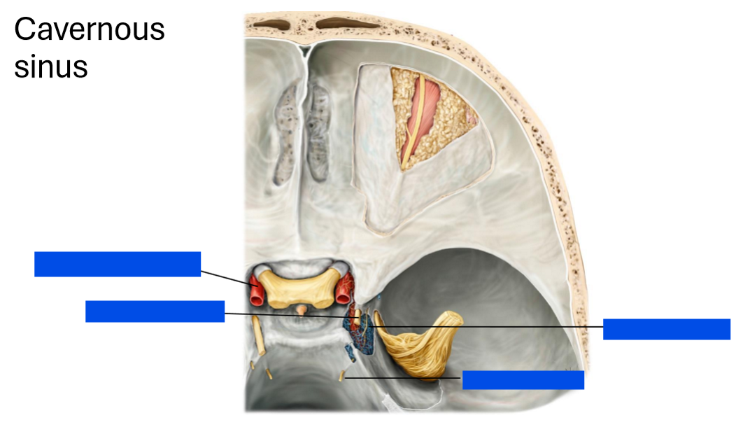 <p>Label the cavernous sinus</p>
