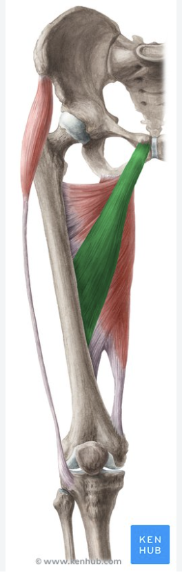 <p>-o: <mark data-color="red" style="background-color: red; color: inherit;">Body of pubis;</mark> anterior surface of inferior pubic ramus</p><p>-i: middle 1/3 of Linea aspera</p><p>-act: hip adduction, flexion</p><p>-in: Obturator n</p><p>-blood:</p><p>-type: flat</p>