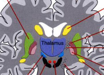 <p>can you label the basal ganglia?</p>