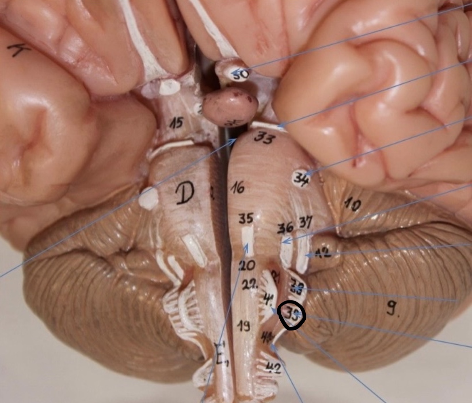 <p>Identify the circled area?</p>