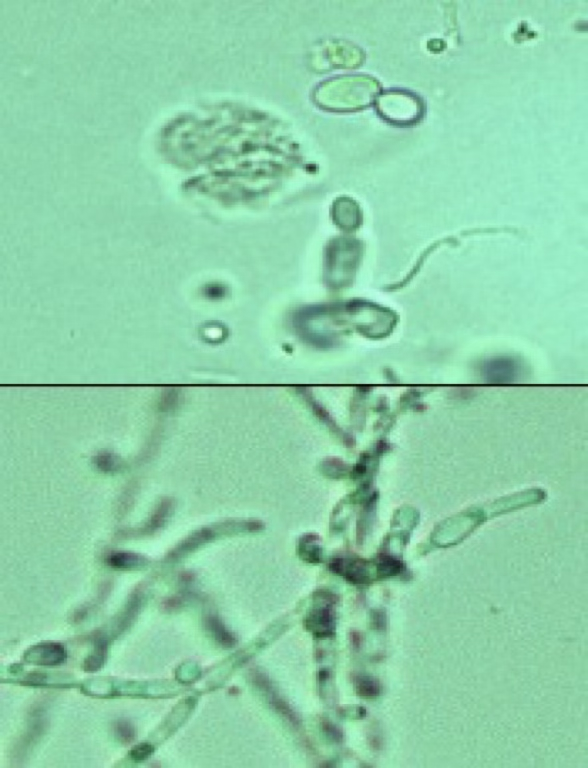 <ul><li><p>Often confused with RBC’s or fat droplets.</p></li><li><p>Peanut man/footprint shaped.</p></li><li><p>Usually considered contaminants when seen in urine sample because this type of infection is rare in animals.</p></li></ul><p></p>