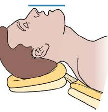 <ul><li><p>Angle headrest into patient’s occipital area</p></li><li><p>This is <strong>chin up position</strong></p></li></ul><p></p>