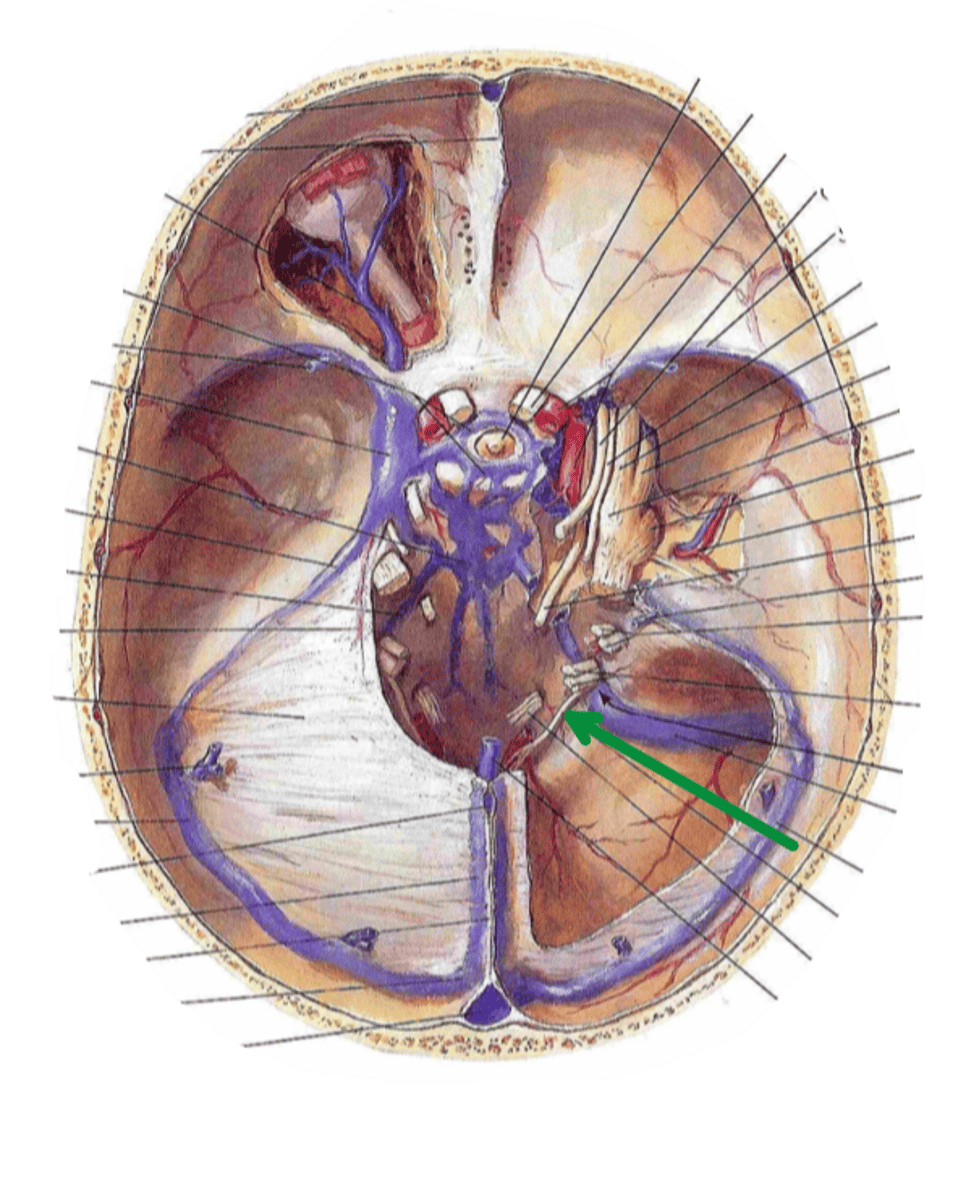<p>Identify the structure indicated by the arrow</p>