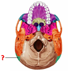 <p>Identify this bone.</p>