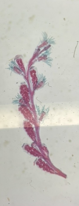 <p>What phylum and class is this? Also what life stage?</p>