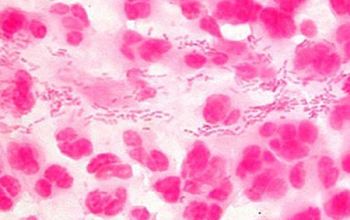 <p>STD</p><p>"school of fish" in direct genital gram stain</p><p>chancroid (ulcer) on the genitals</p><p>not a part of normal flora</p>