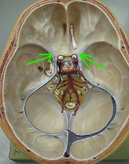 term image