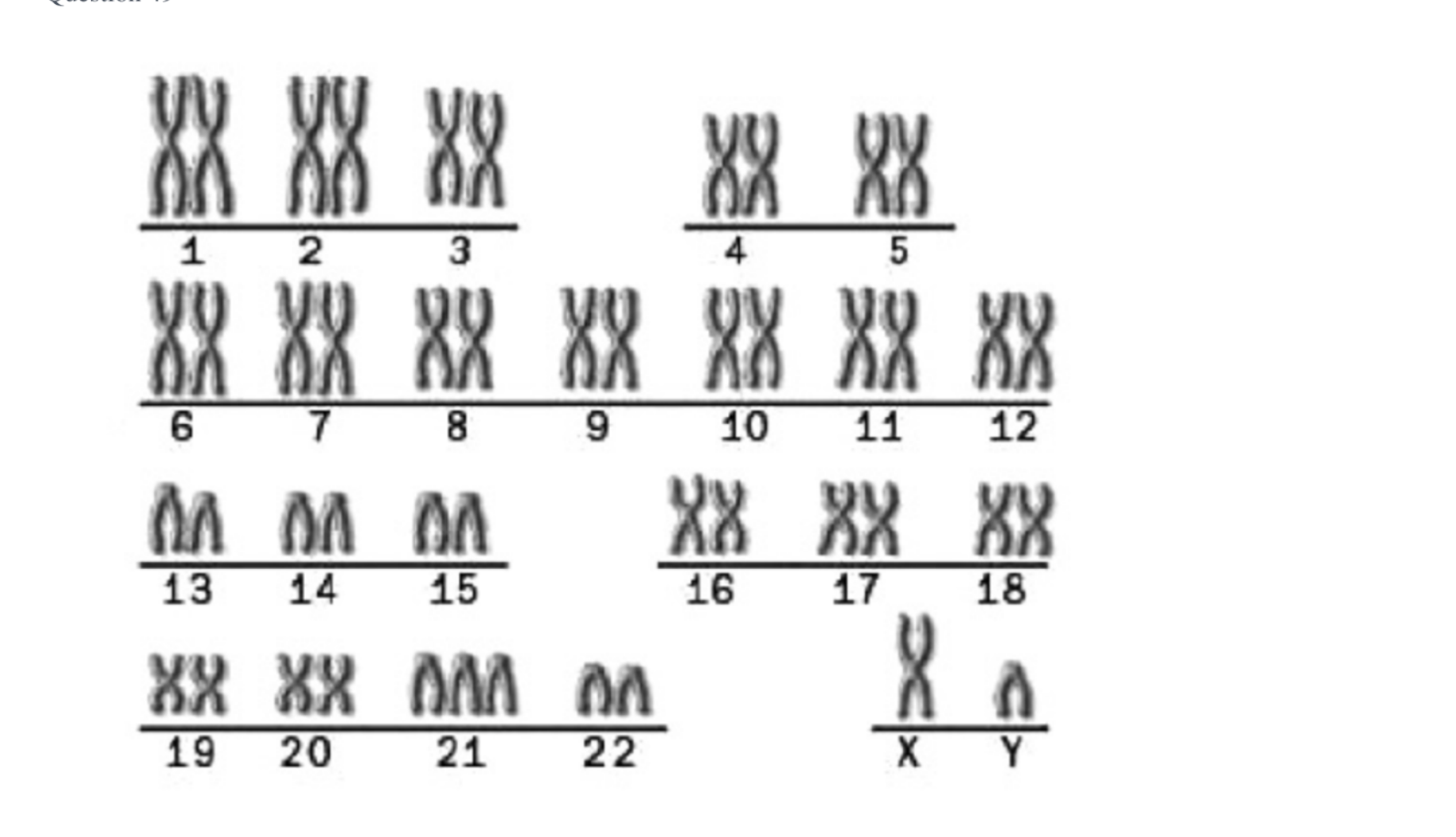 <p><span>Based on the above karyotype, you are looking at a...</span></p>