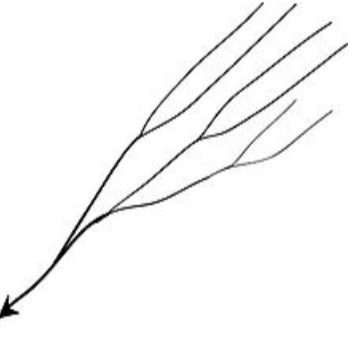 <p>Develops on a surface that slopes uniformly and is fairly steep. The river and its tributaries flow downslope nearly PARALLEL to one another.</p>