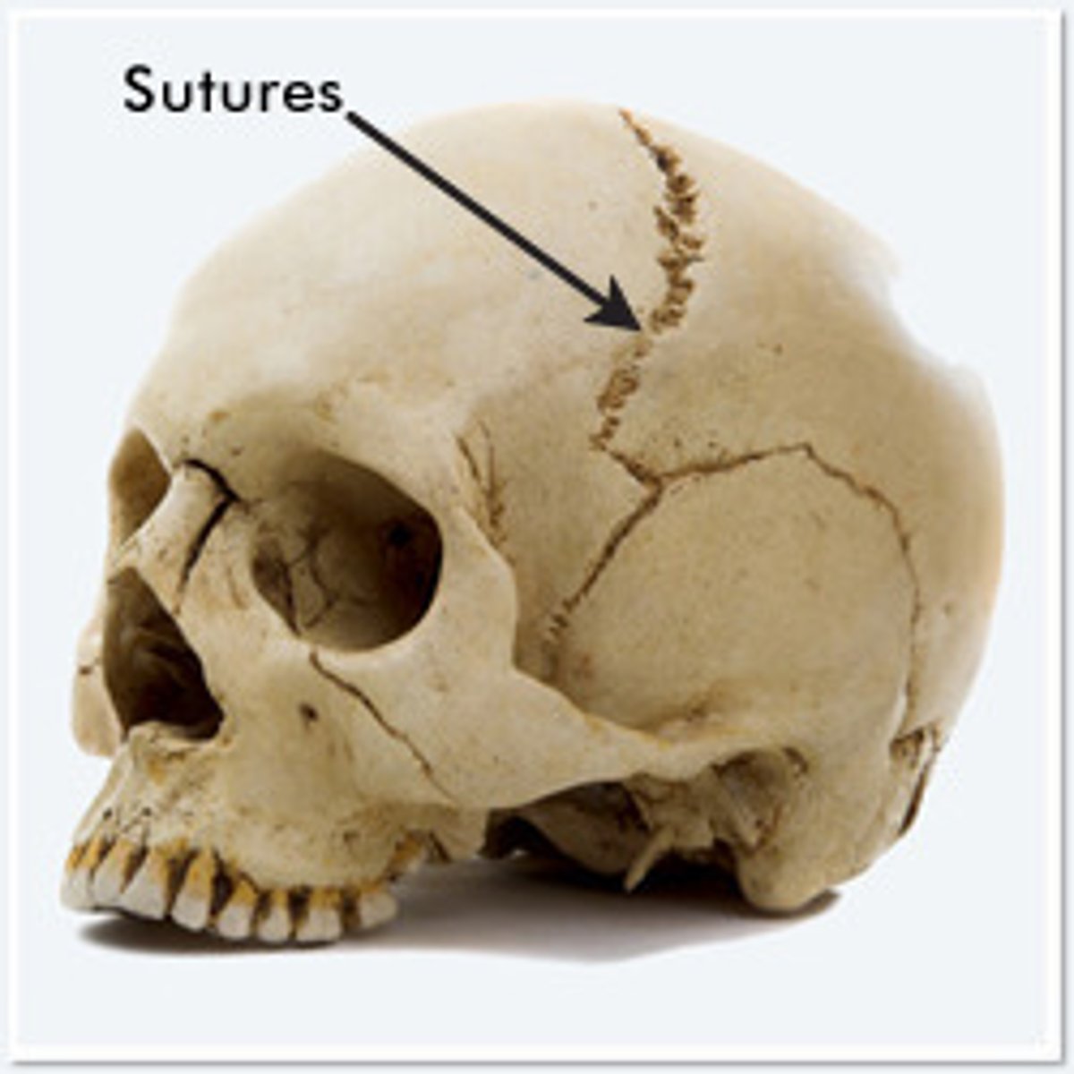 <p>immovable joint</p>
