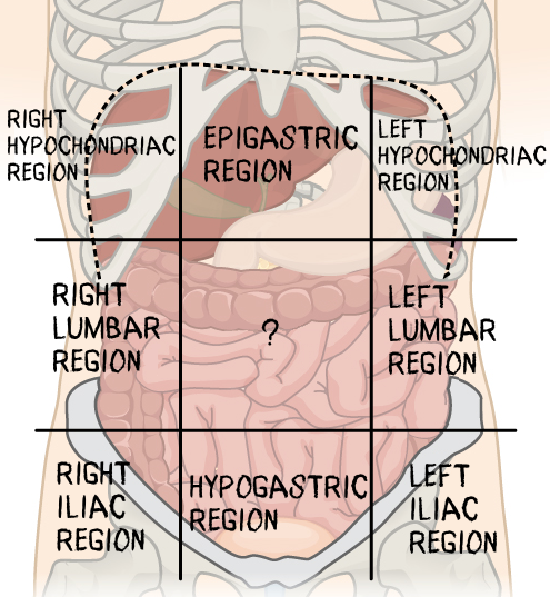 <p>Which abdominopelvic region is missing?</p>
