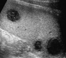 <p>Identify this image. </p>