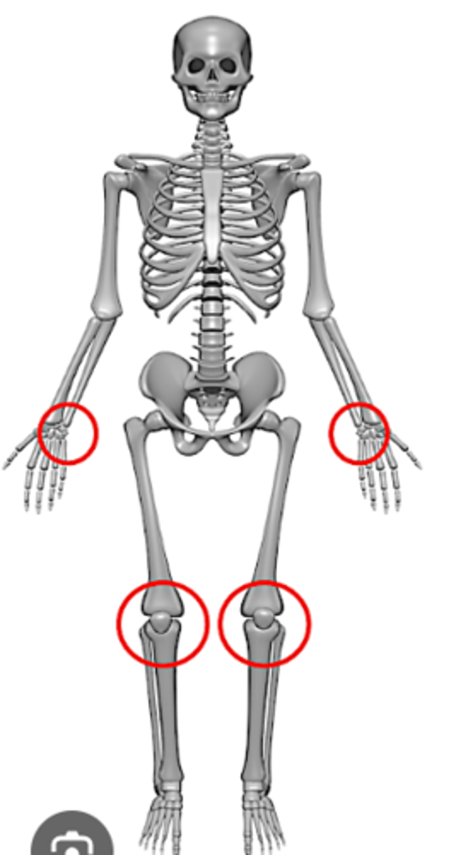 <p>round bones found near joints (e.g., the patella or knee caps). These bones are good at protecting the tendons from wear.</p>