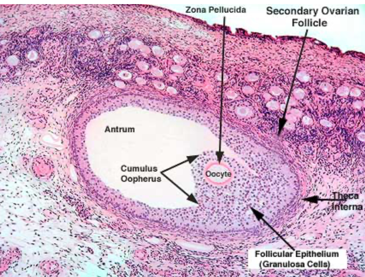term image