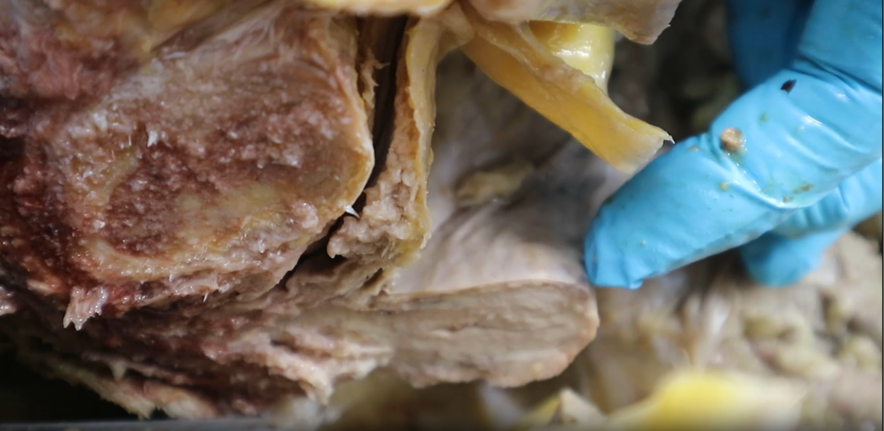 <p>blue glove pointing to…</p>