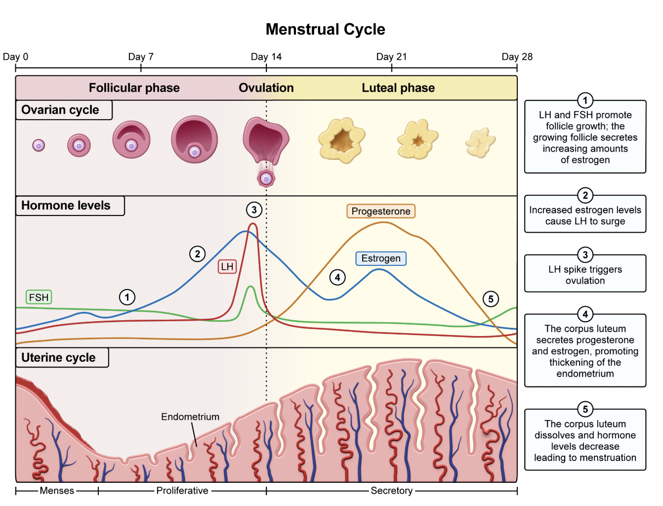 <ul><li><p><span>luteal phase is characterized by the development of the corpus luteum and its secretion of estrogen and progesterone, which act to thicken the endometrium of the uterus</span></p></li></ul><p><span style="line-height: 1.6em; font-size: inherit;">The ovarian cycle&nbsp;consists of three phases:</span></p><ol><li><p><span style="line-height: 1.6em;"><strong>Follicular phase:</strong> Follicle develops and secretes increasing estrogen. Increasing estrogen causes a surge of luteinizing hormone (LH).</span></p></li><li><p><span style="line-height: 1.6em;"><strong>Ovulation:</strong> The egg is released into the oviduct (fallopian tube).</span></p></li><li><p><span style="line-height: 1.6em;"><strong>Luteal phase:&nbsp;</strong>The <strong>corpus luteum</strong> secretes estrogen and progesterone to thicken the endometrium of the uterus.</span></p></li></ol><p></p><p><em>B. Ovary releases a secondary oocyte</em></p><p><span style="line-height: 1.6em; font-size: inherit;">The <u>secondary oocyte</u></span><strong>&nbsp;</strong><span style="line-height: 1.6em; font-size: inherit;">is released during ovulation,&nbsp;</span><em>not&nbsp;</em><span style="line-height: 1.6em; font-size: inherit;">the luteal phase. This occurs as the mature follicle in the ovary ruptures, releasing the secondary oocyte into the <u>fallopian tube</u>. If sperm is present in the fallopian tube, <u>fertilization</u>&nbsp;of the secondary oocyte can occur.</span></p><p><em>C. </em><span style="line-height: 1.6em; font-size: inherit;"><em>Follicle-stimulating hormone peaks</em></span></p><p><span style="line-height: 1.6em; font-size: inherit;"><em>D.&nbsp;Luteinizing hormone peaks</em></span></p><p><span style="line-height: 1.6em; font-size: inherit;">Follicle-stimulating hormone (FSH)&nbsp;and&nbsp;LH&nbsp;peak during the follicular phase, <em>not</em> the luteal phase.</span></p><p><em>E. Primary follicles develop</em></p><p><span style="line-height: 1.6em; font-size: inherit;">During the follicular phase, FSH stimulates the maturation of primary follicles into estrogen-secreting secondary follicles.</span></p>