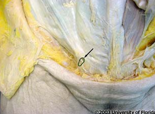 <p>what structure is being indicated to in the image</p>