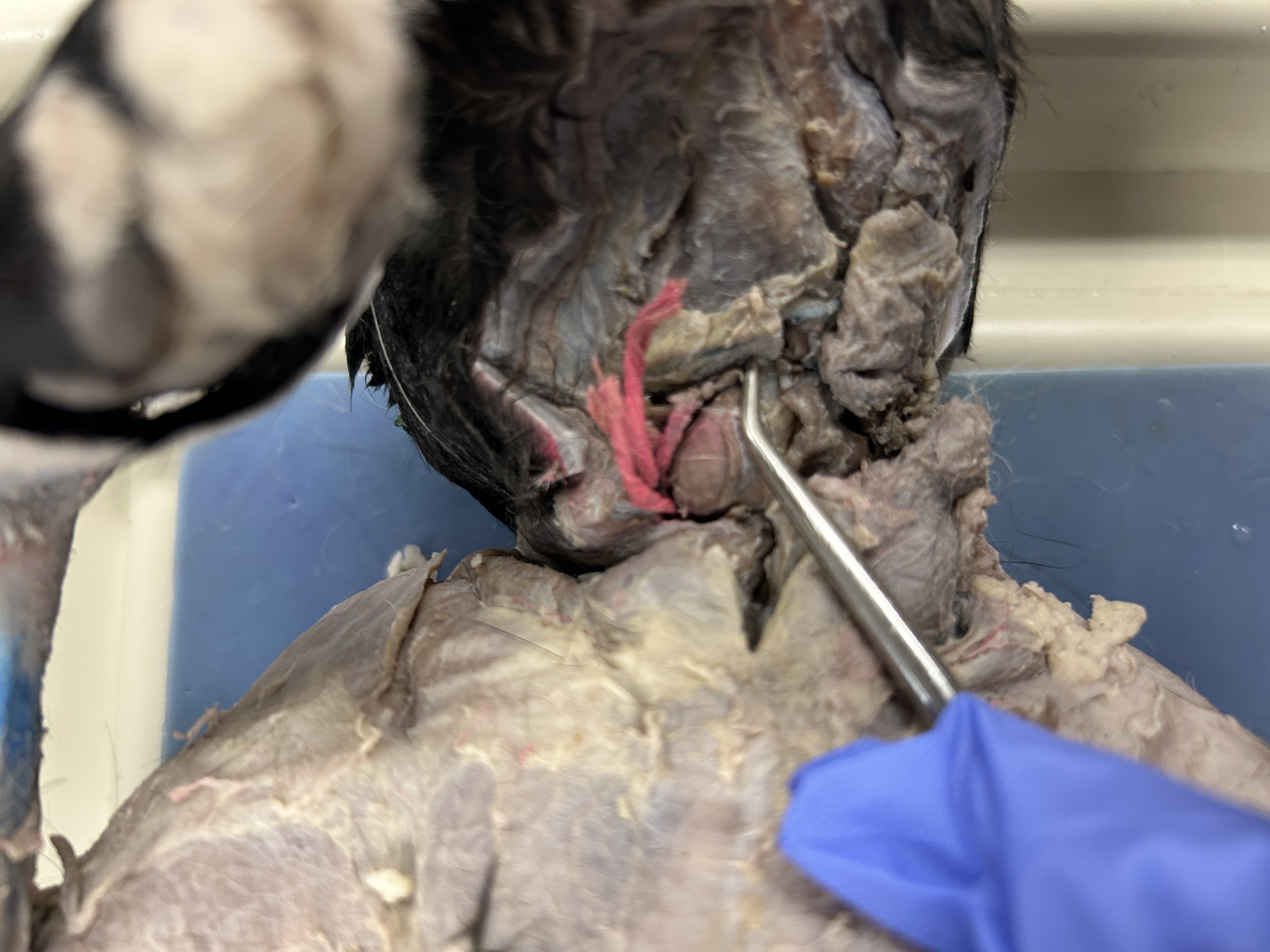 <p>Sternohyoid (under blue line/vein) </p>