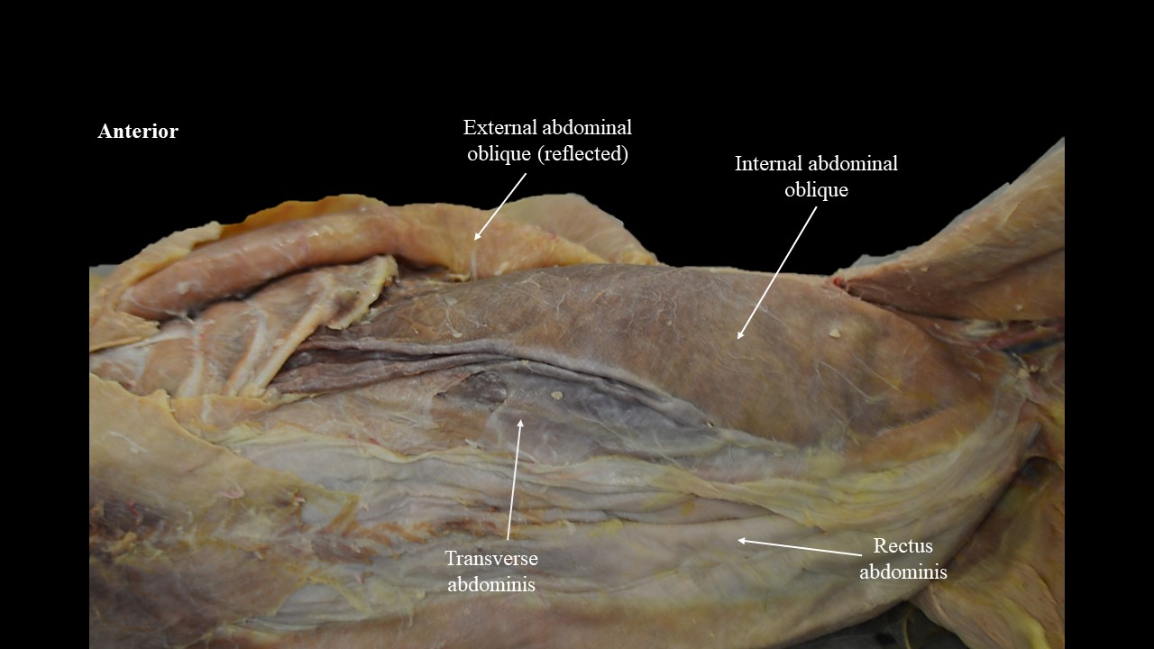 <p>Abdominal Wall, immediately deep to external oblique</p>