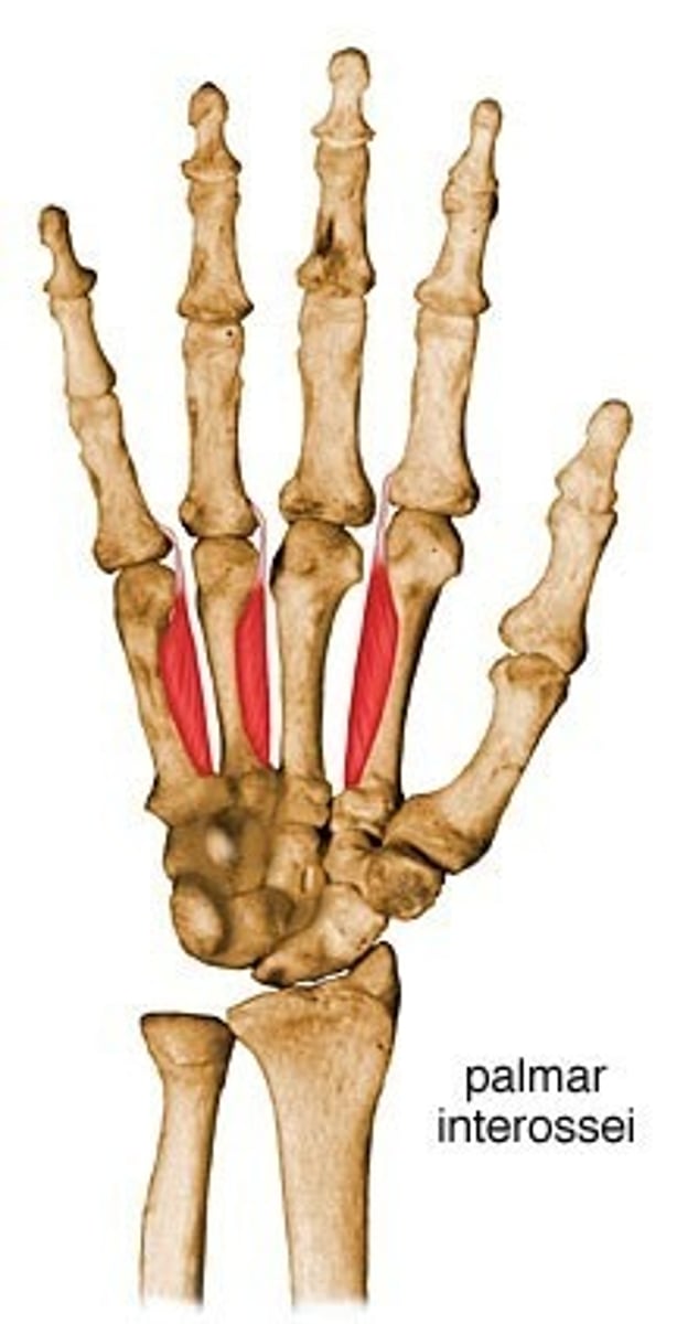 <p>Palmar surfaces of metacarpals 2, 4, and 5</p>
