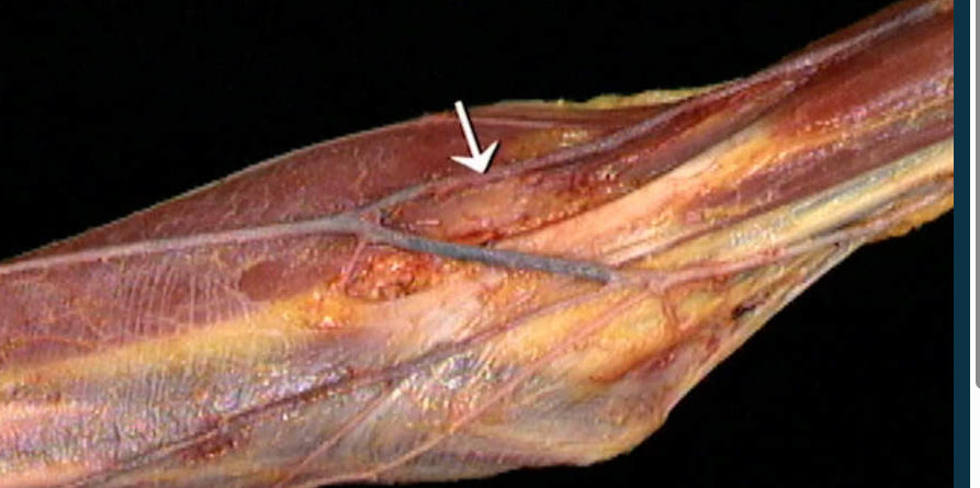 <p>Oppervlakkige venen?</p>