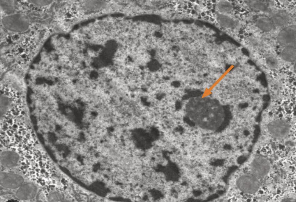 <p>Appears as a large, dense, dark, round or oval spot inside the cell's nucleus</p>