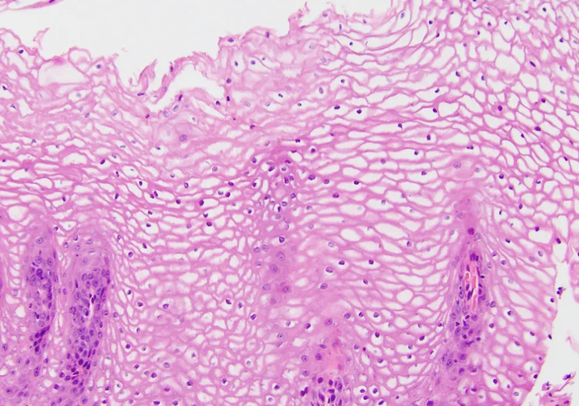 <p>Oesophage, diagnostic </p>