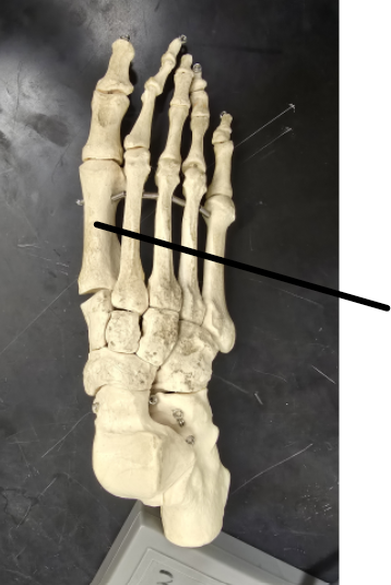 <p>Name Tarsal Bone</p>