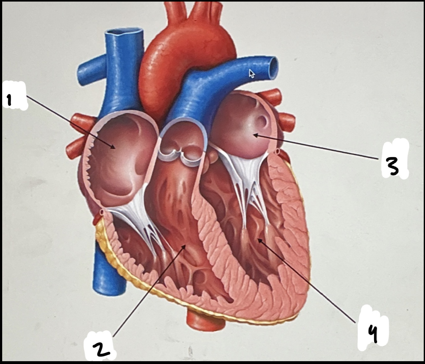 <p>Heart</p><p>Chambers</p><p>■ Right Atrium (RA)</p><p>■ Right Ventricle (RV)</p><p>■ Left Atrium (LA)</p><p>■ Left Ventricle (LV)</p>