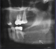 <p>Describe the characteristics of the lesion:</p>