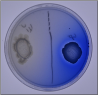 <p>differential</p><p>tests for enzyme lipase which hydrolyzes fats into glycerol and fatty acids</p>