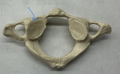 <p>What is the arrow pointing to?</p>