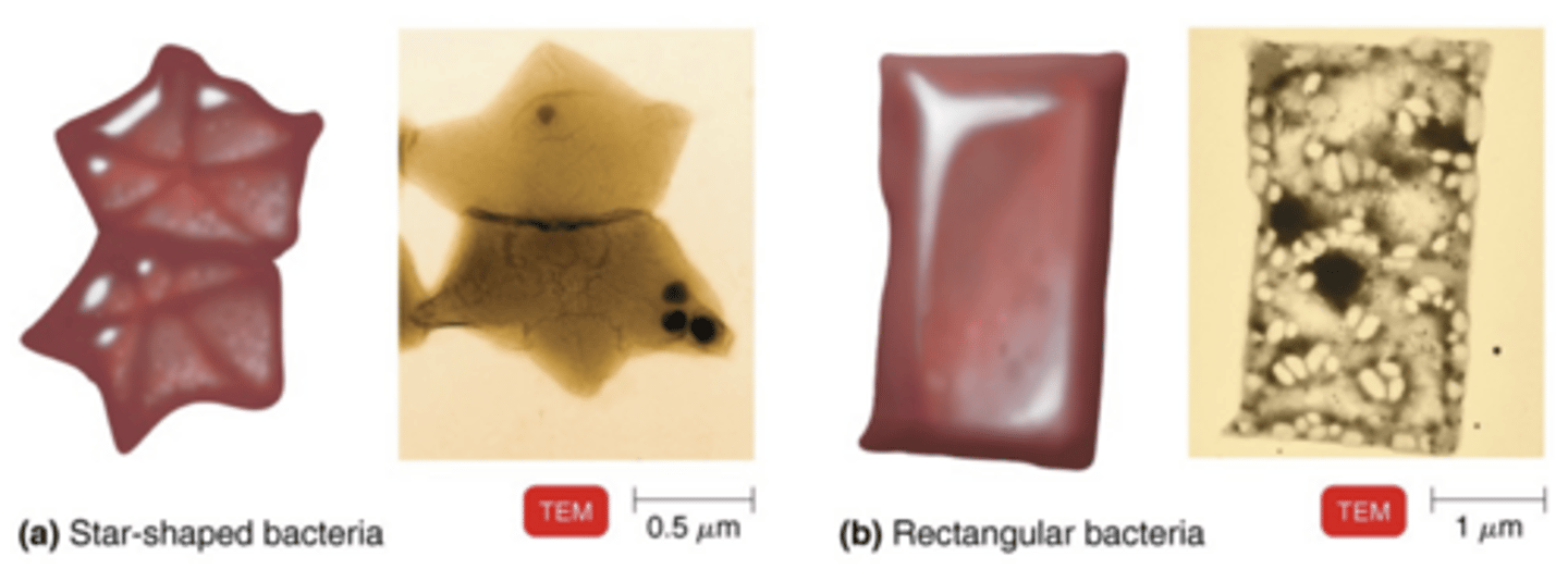 <p>Star-shaped and rectangular bacteria.</p>