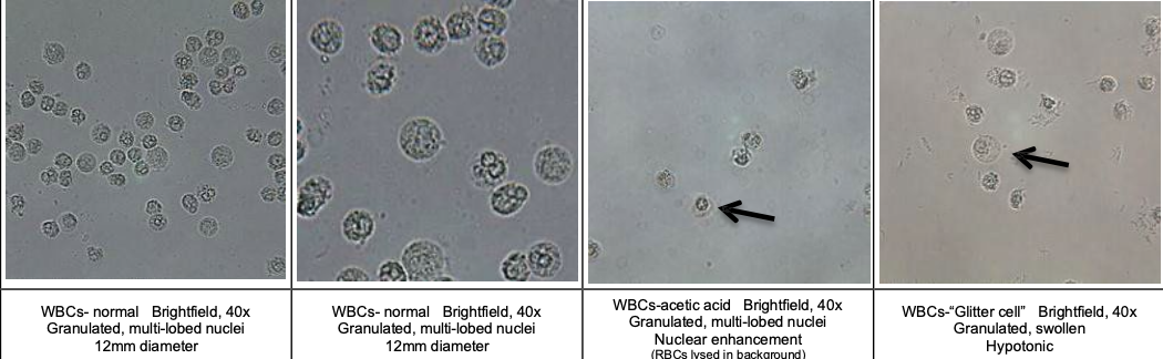<p>WBC</p>