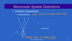 <p>Partition Experiment</p><p>Where would a patient look if there was more "nasal" packing of the OD?</p>