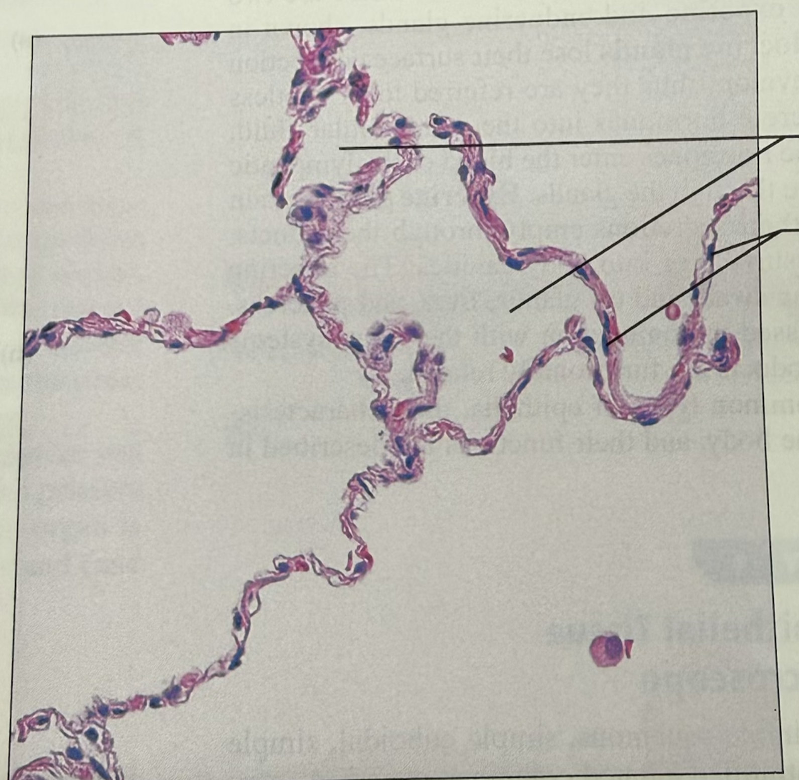 <p>what tissue is this</p>