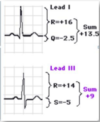 <p>summējot visu pozitīvu un negatīvu QRS svārstību amplitūdas</p>