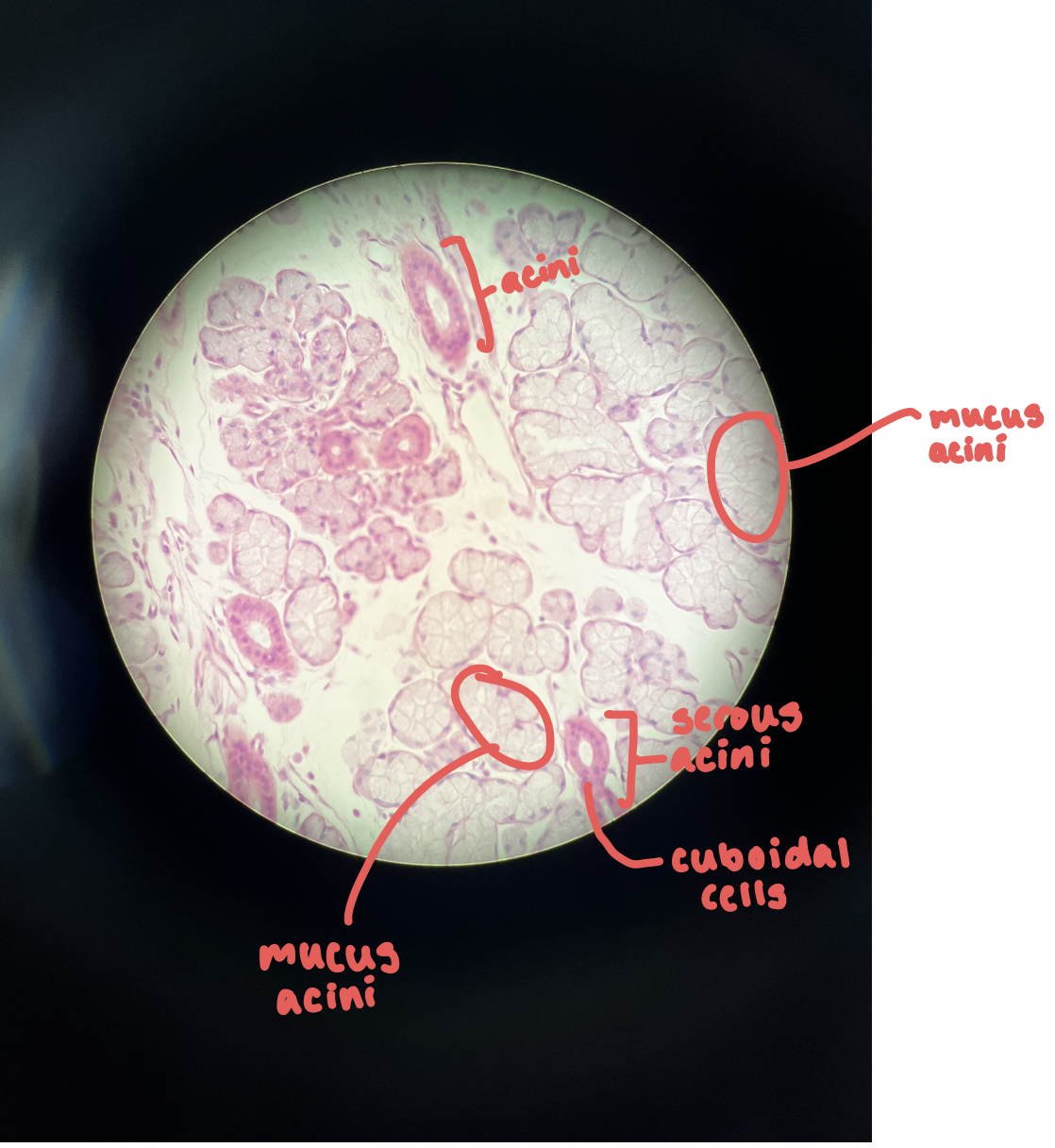 <p>Parotid, sublingual, submandibular </p>