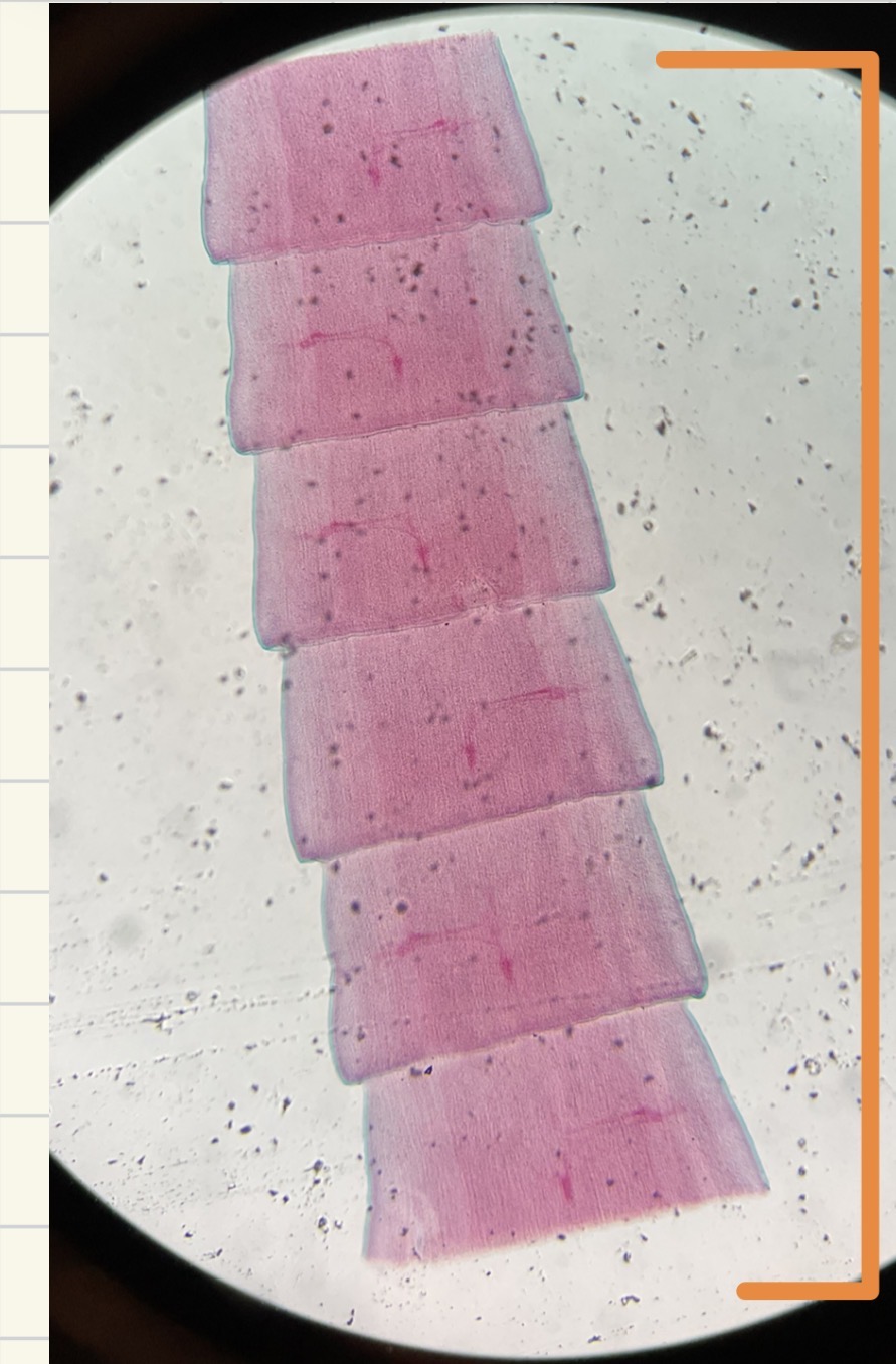 <p>What is this structure </p>