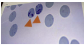 <p><span>New Methylene Blue (NMB) stain is used to identify reticulocytes and Heinz bodies.</span></p>