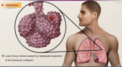 <p>collapse of alveoli. these are little air sacs at the end of the lung where gas exchange takes place. it can be acute or chronic, but more commonly acute. there are lots of risk factors for this but most important: IMMOBILIZATION, SHALLOW BREATHING, and ANESTHESIA. not moving around as much and shallowing breathing means those alveoli arent being fully inflated, therefore more likely to collapse.</p>