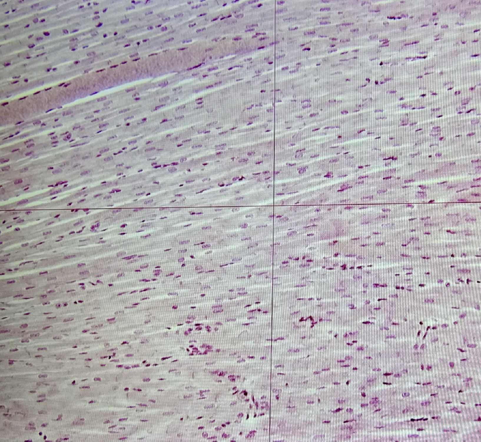 <ul><li><p>nucleus</p></li><li><p>myofibrils (a and i bands)</p></li><li><p>intercalated disk</p></li></ul><p></p>